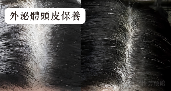 JE心怡美顏館 外泌體頭皮保養 1