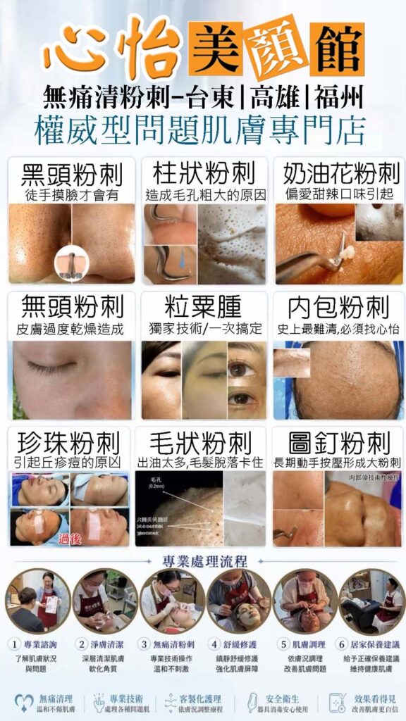 無痛清粉刺教學招生中|高雄美容教學、台東美容教學、福州美容教學與美容創業技術課程推薦 2 心怡美顏館 無痛清粉刺